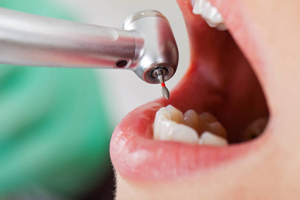 Professional Emergency Dental Service in OH